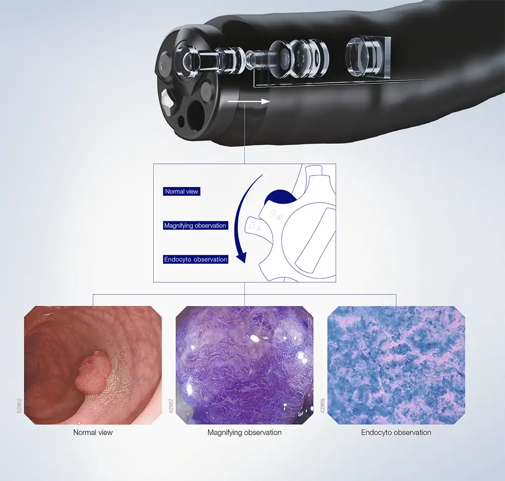 Operation of the Zoom Lever to Change Magnification Levels Operation of the Zoom Lever to Change Magnification Levels