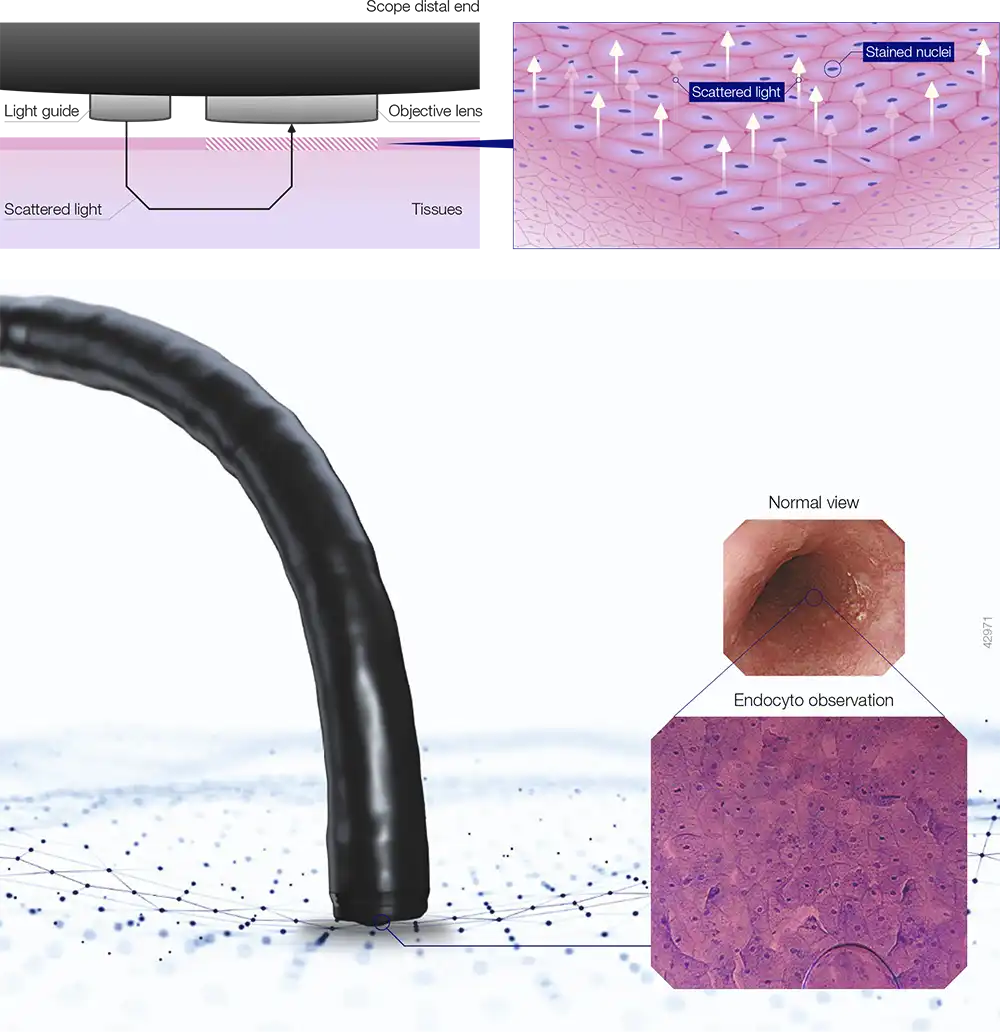 Principle of Endocyto Observation Principle of Endocyto Observation