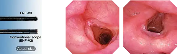 Surprisingly Slim Diameter